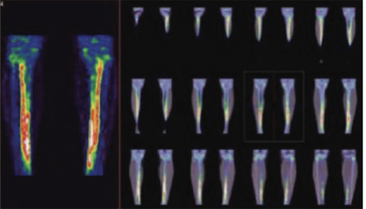 Orthopaedic