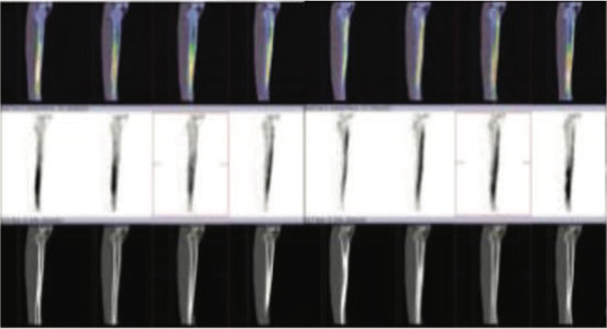Orthopaedic