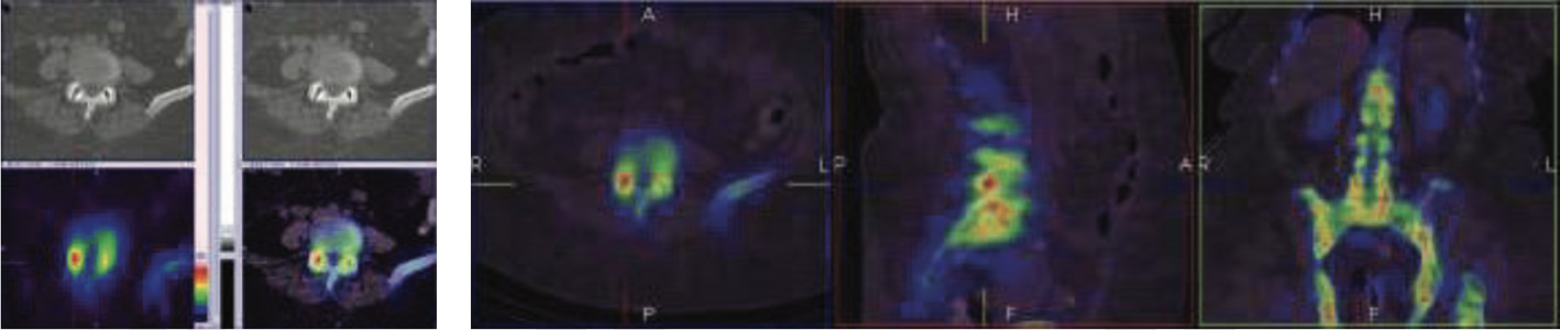 Orthopaedic