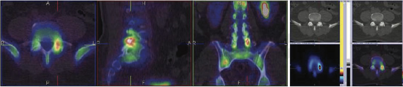 Orthopaedic