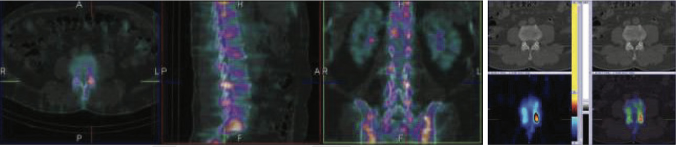 Orthopaedic