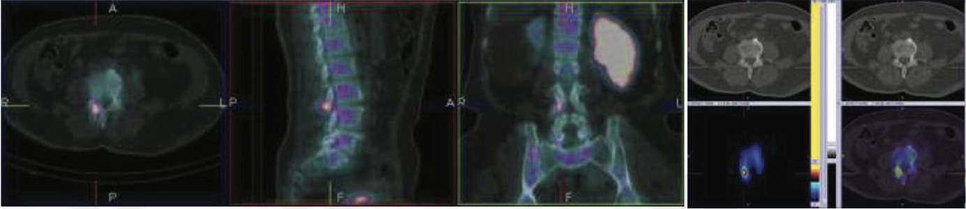 Orthopaedic