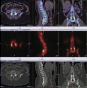 Orthopaedic