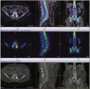 Orthopaedic