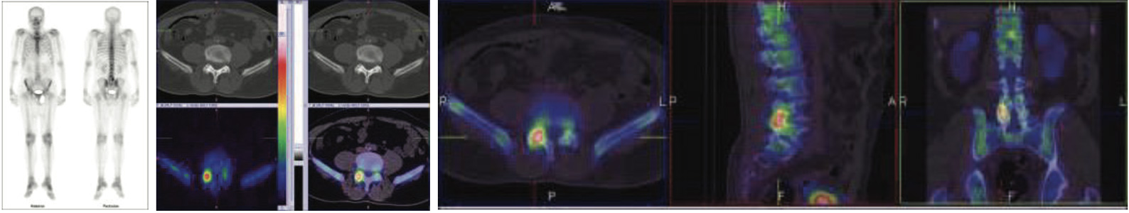Orthopaedic