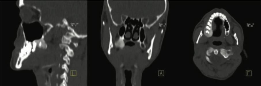 Orthopaedic