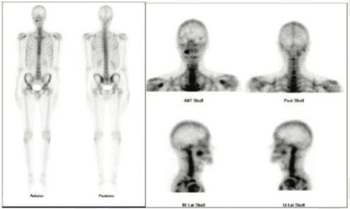 Orthopaedic