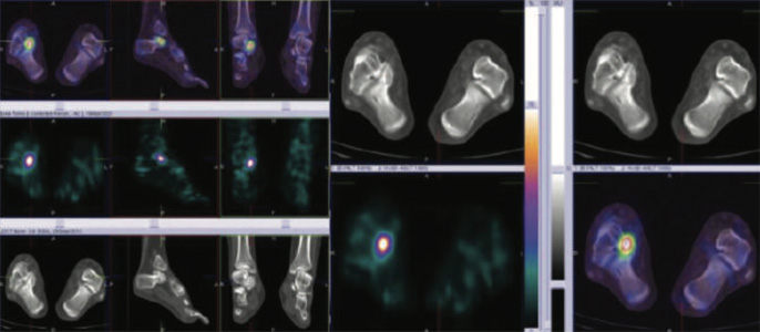 Orthopaedic