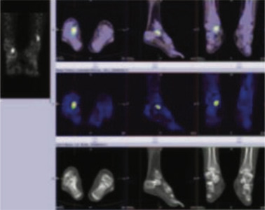 Orthopaedic