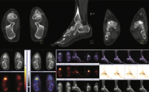 Orthopaedic