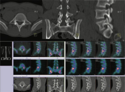 Orthopaedic