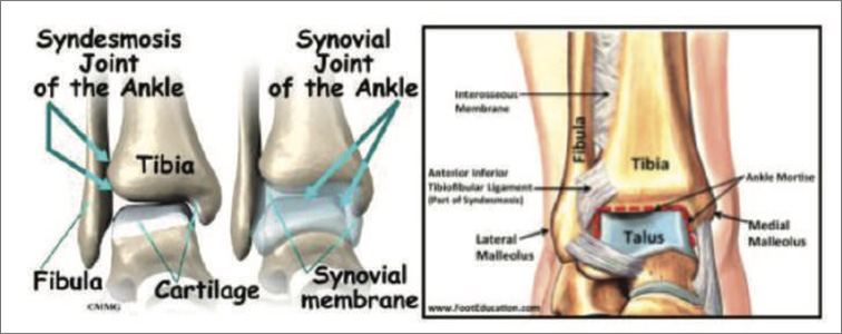 Orthopaedic