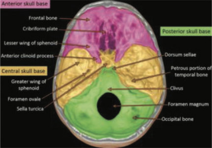 Orthopaedic