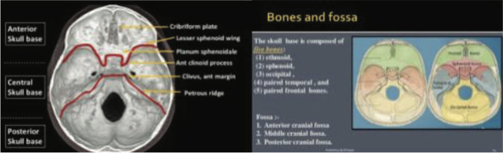 Orthopaedic